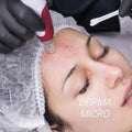 Microneddle facial